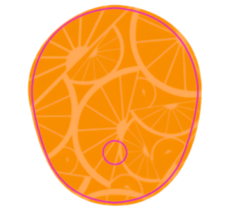Dexcom G7: Orange Patch Set
